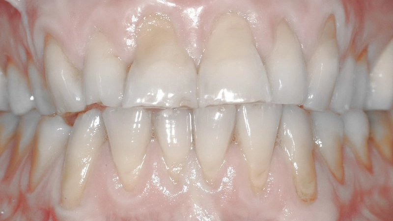 Riabilitazione estetica con chirurgia 2 Riabilitazione estetica con chirurgia